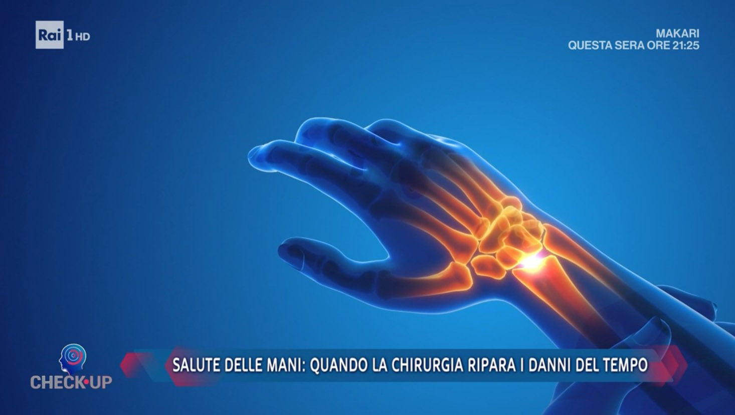 A Check Up si parla di salute delle mani